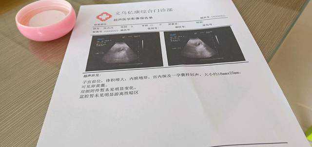 广州哪些医院可以做供卵试管