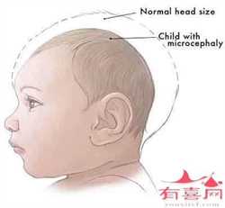 广州包生男孩试管供卵婴儿，北京哪家医院做试管婴儿好 试管婴儿有几种